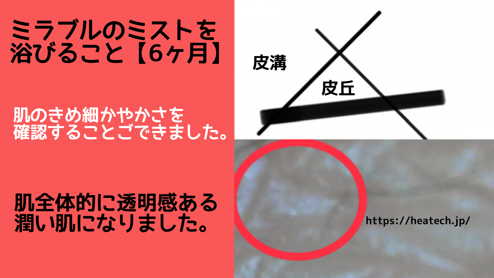 肌の説明をしている画像